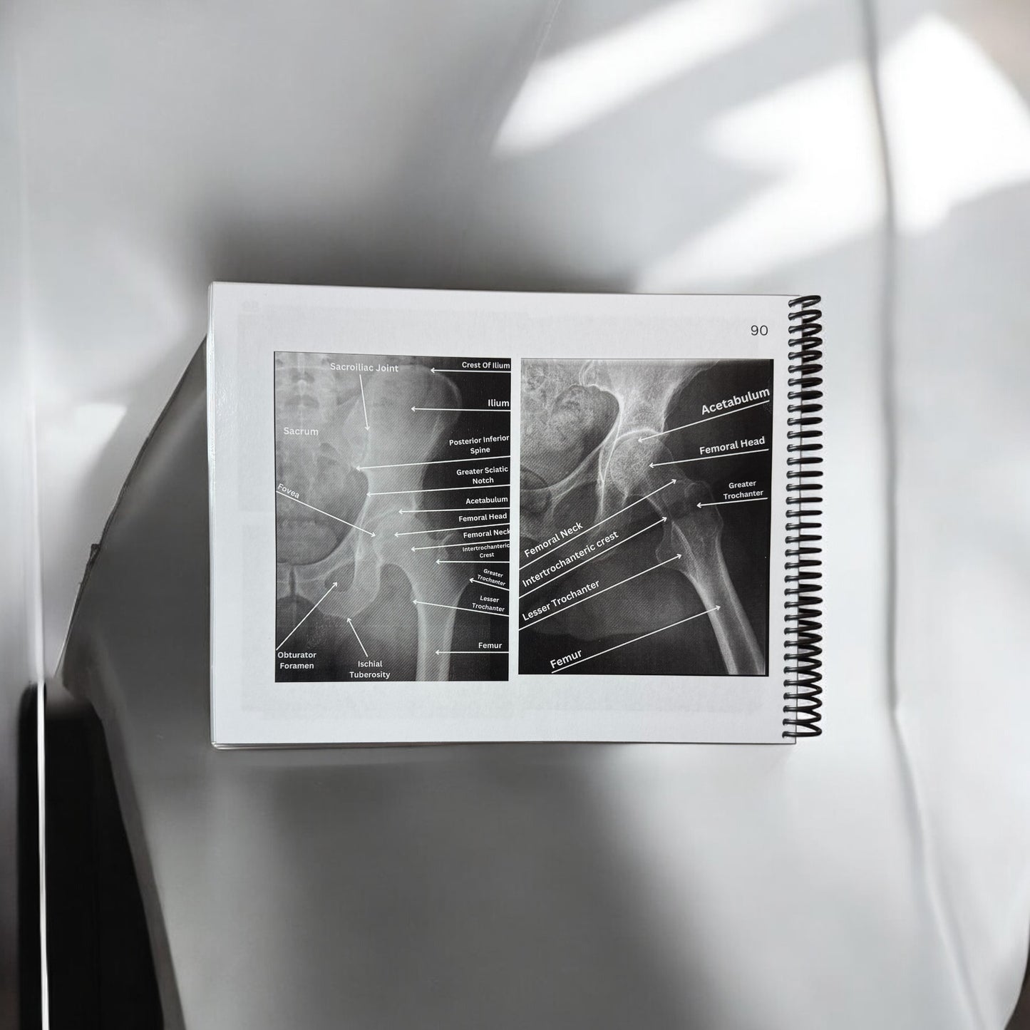 X-Ray Workbook