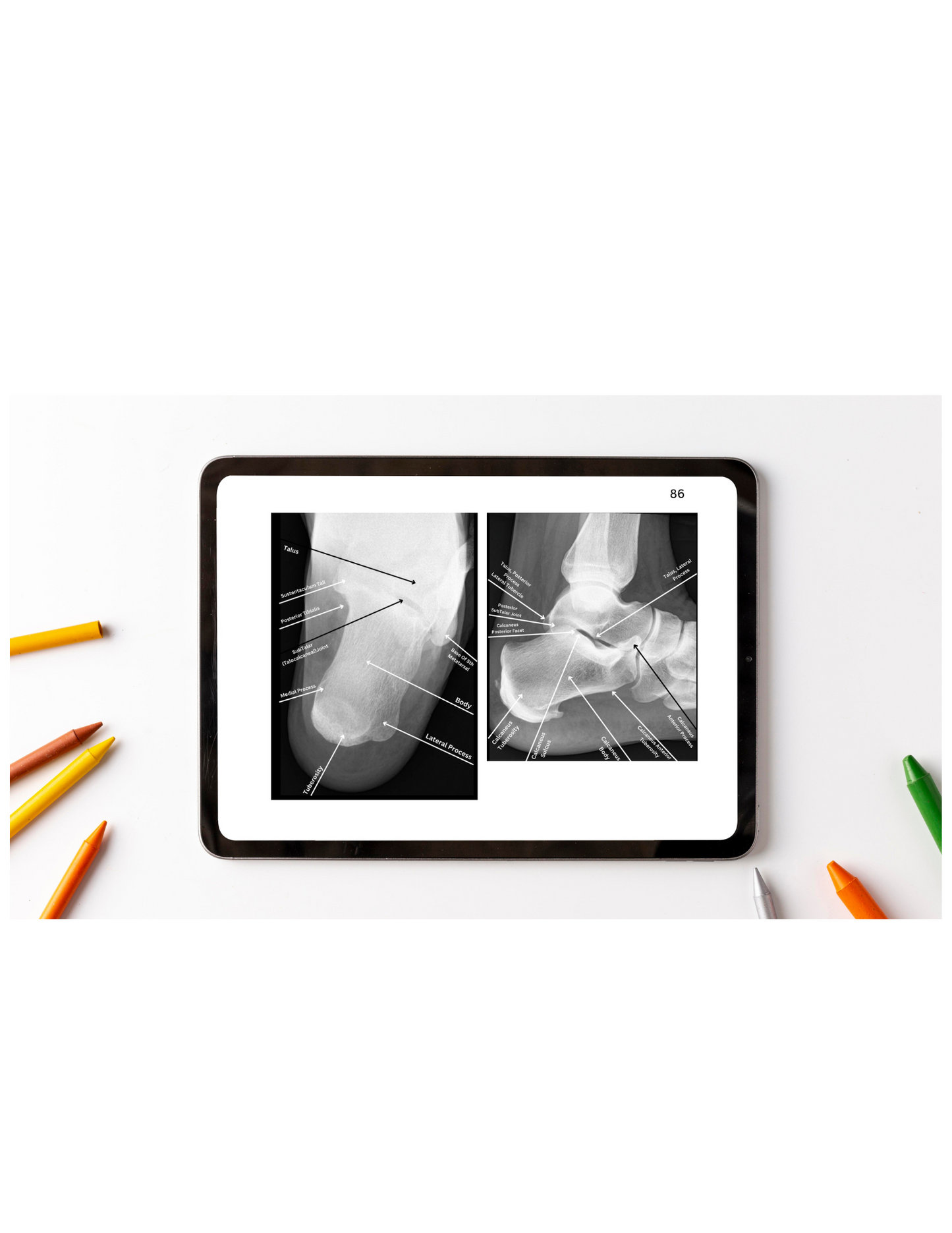 X-Ray Workbook (Digital)