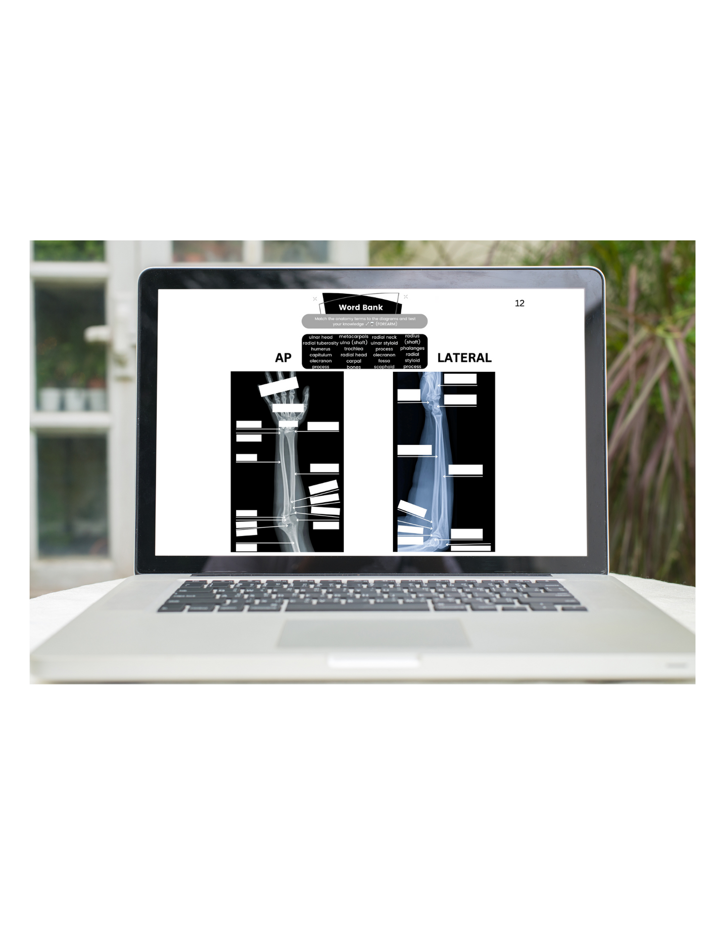 X-Ray Workbook (Digital)