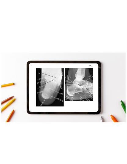 X-Ray Workbook (Digital)