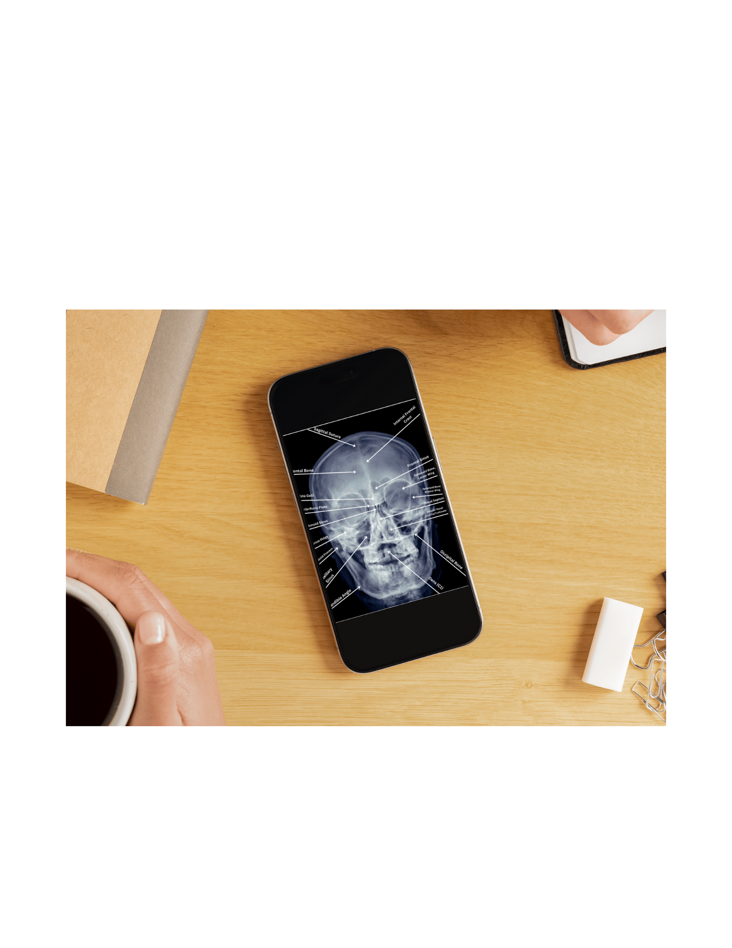 X-Ray Workbook (Digital)